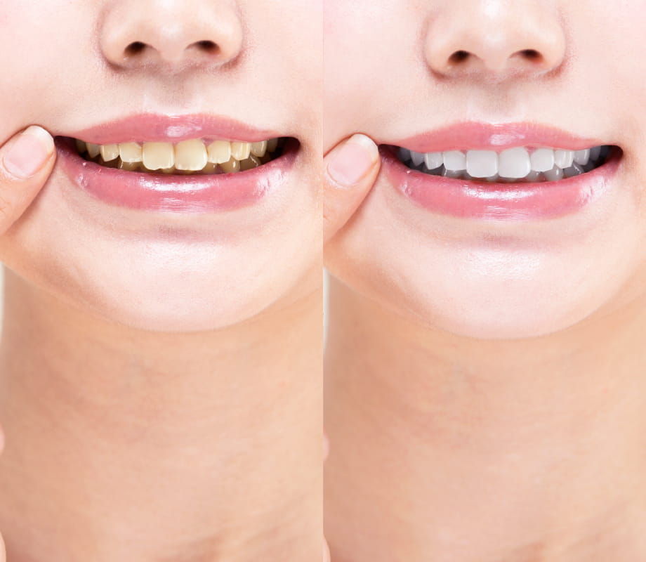 img_whitening_pc.jpg
